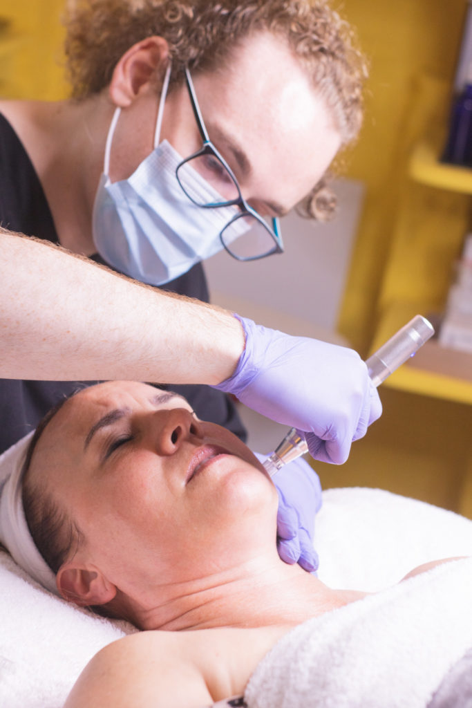 Micro-needling being performed on a clients face.